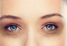 চোখের কালো দাগ দূর করবেন যেভাবে